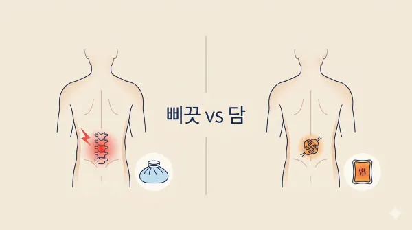 허리 삐끗했을때 vs 담 걸렸을때, 뭐가 다른지 정리했습니다